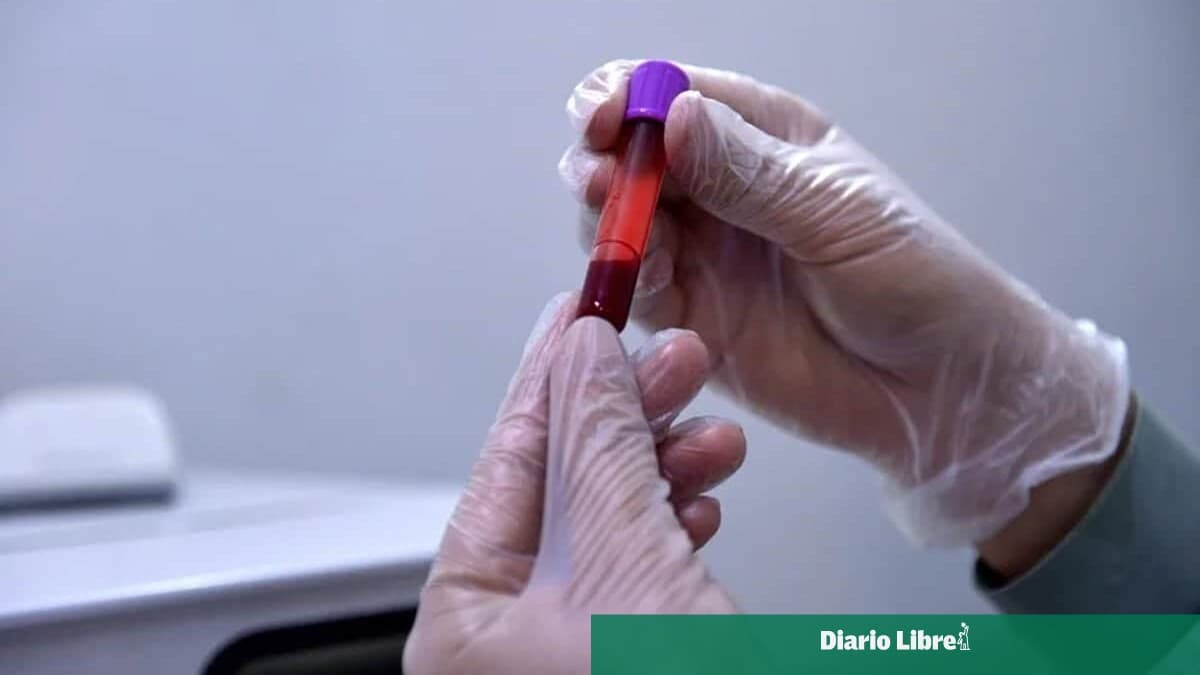 Un estudio valida el uso de muestras de sangre capilar para el control antidopaje